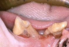Parodontitis bei der Katze