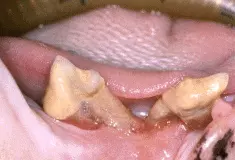 Parodontitis bei der Katze